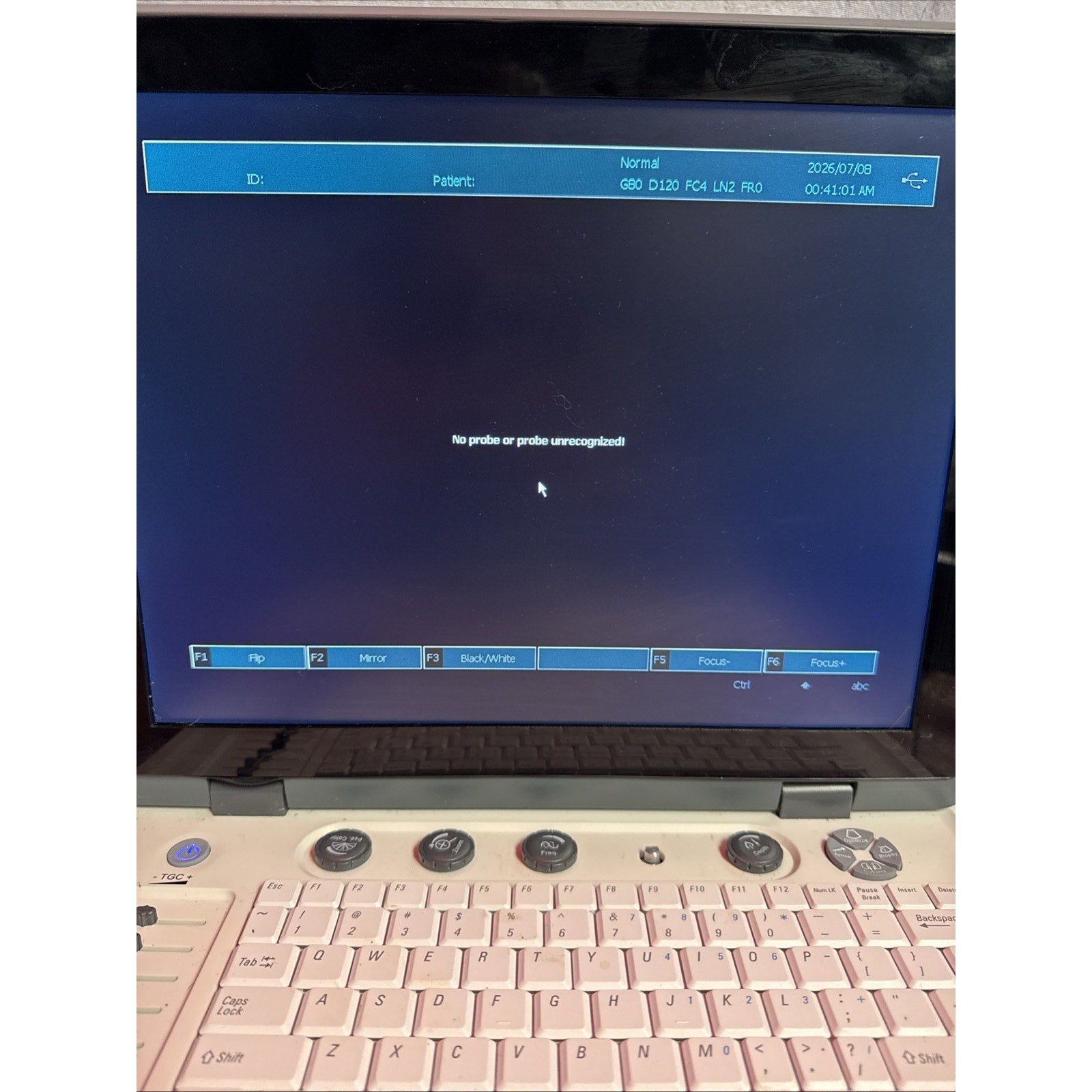 15" Portable Laptop Ultrasound Scanner Machine Diagnostics Ultrasound System