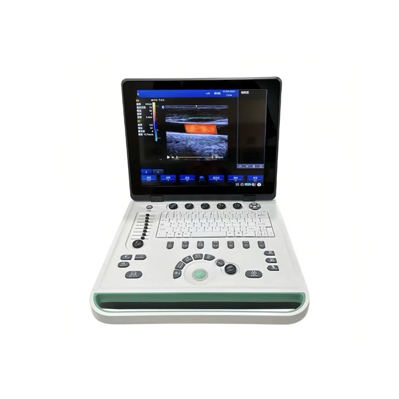 15" Portable Laptop Ultrasound Scanner Machine Diagnostics Ultrasound System